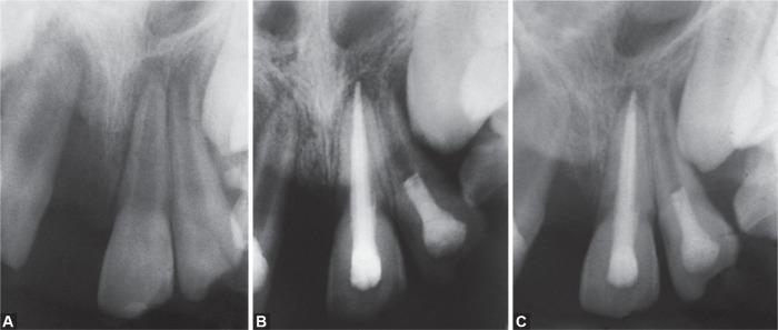 https://cdn.ncbi.nlm.nih.gov/pmc/blobs/0d80/7299885/0e1810ddbf2f/ijcpd-13-98-g002.jpg