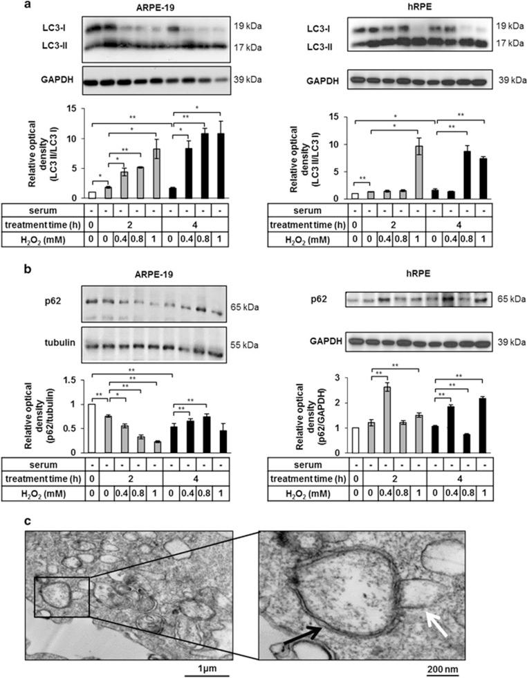 https://cdn.ncbi.nlm.nih.gov/pmc/blobs/0d89/5059849/7830fbf7a3b5/cddis2016133f1.jpg