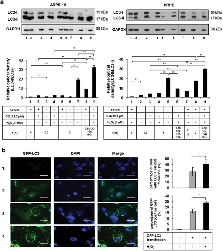 https://cdn.ncbi.nlm.nih.gov/pmc/blobs/0d89/5059849/fc9a50e4bc9f/cddis2016133f2.jpg