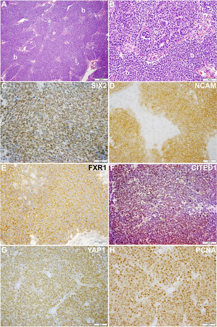 https://cdn.ncbi.nlm.nih.gov/pmc/blobs/0d8b/10061139/04727ffbc2cd/fonc-13-1091274-g001.jpg