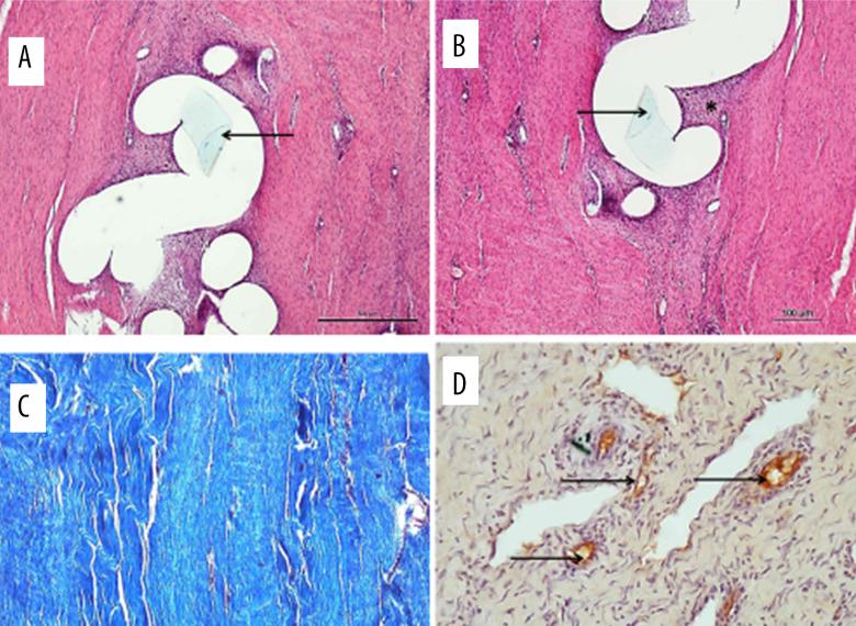 https://cdn.ncbi.nlm.nih.gov/pmc/blobs/0d8c/8434771/427e1ed69c35/medscimonit-27-e929709-g005.jpg