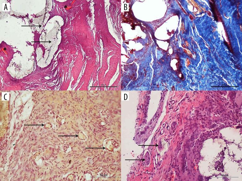 https://cdn.ncbi.nlm.nih.gov/pmc/blobs/0d8c/8434771/532481761c23/medscimonit-27-e929709-g007.jpg