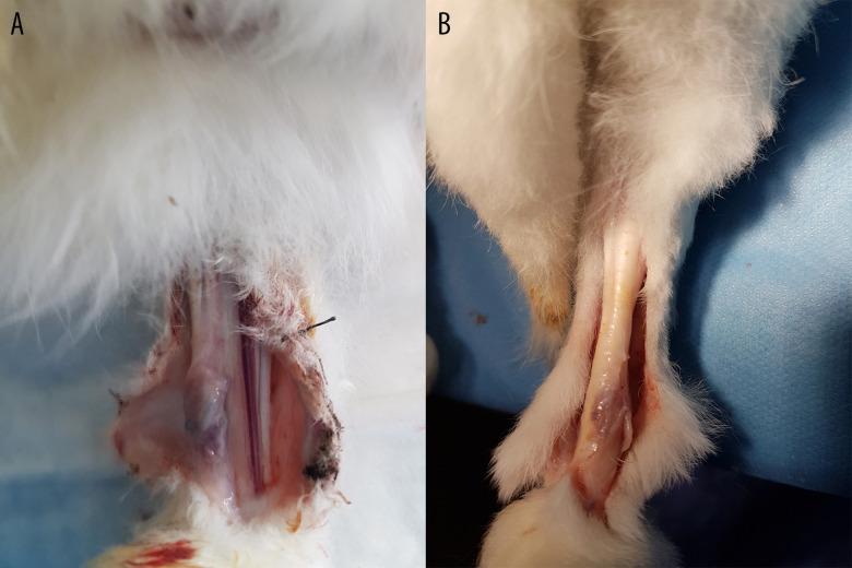 https://cdn.ncbi.nlm.nih.gov/pmc/blobs/0d8c/8434771/b7ccae147129/medscimonit-27-e929709-g004.jpg