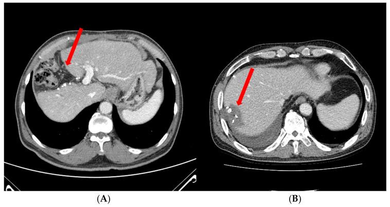 https://cdn.ncbi.nlm.nih.gov/pmc/blobs/0d91/11640626/37494782e060/cancers-16-04093-g001.jpg