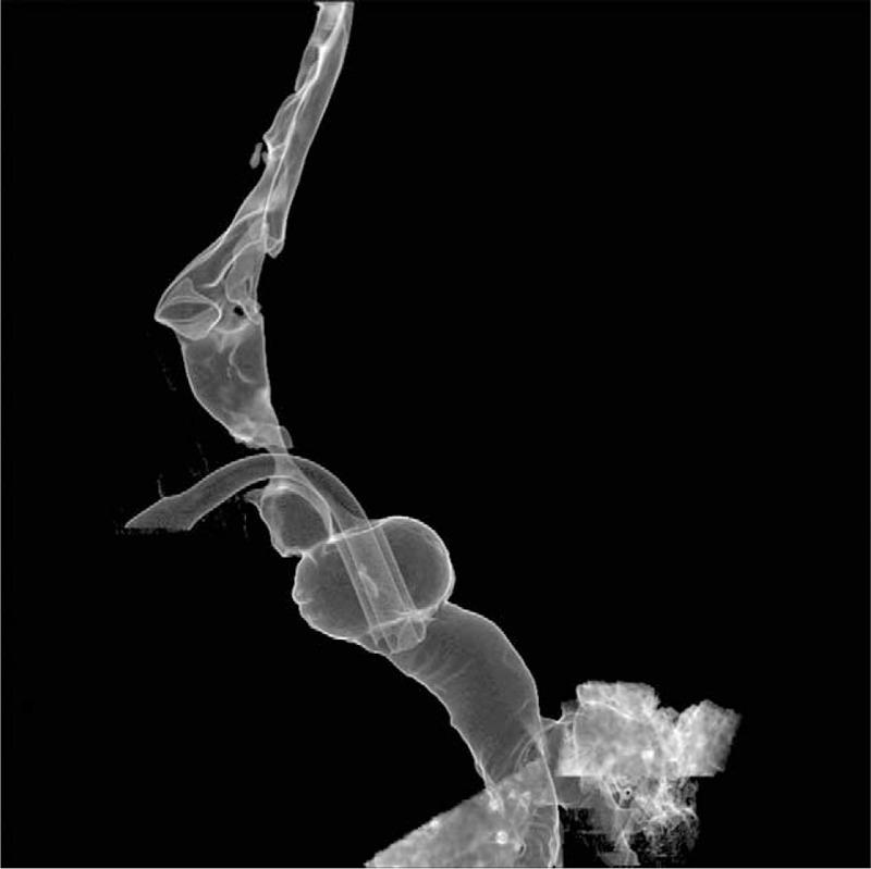 https://cdn.ncbi.nlm.nih.gov/pmc/blobs/0d9b/4620792/f7917915e189/medi-94-e1763-g002.jpg