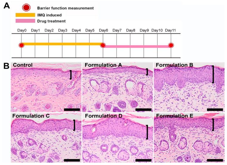 https://cdn.ncbi.nlm.nih.gov/pmc/blobs/0d9e/7284938/f6d7d745bd33/pharmaceutics-12-00457-g002.jpg