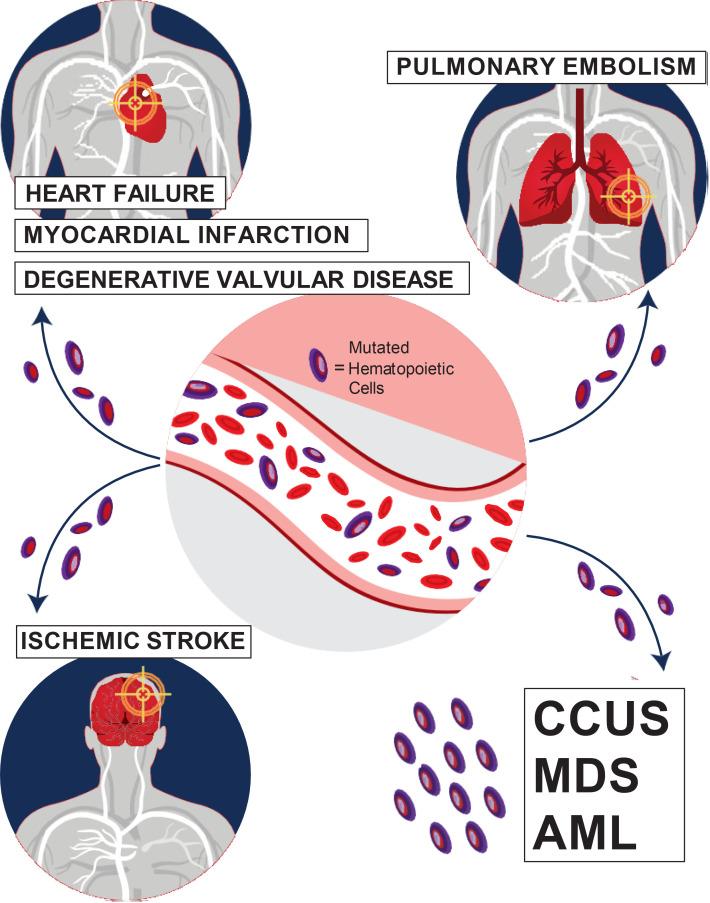 https://cdn.ncbi.nlm.nih.gov/pmc/blobs/0da3/8791167/e23268431517/hem.2021000272_s1.jpg