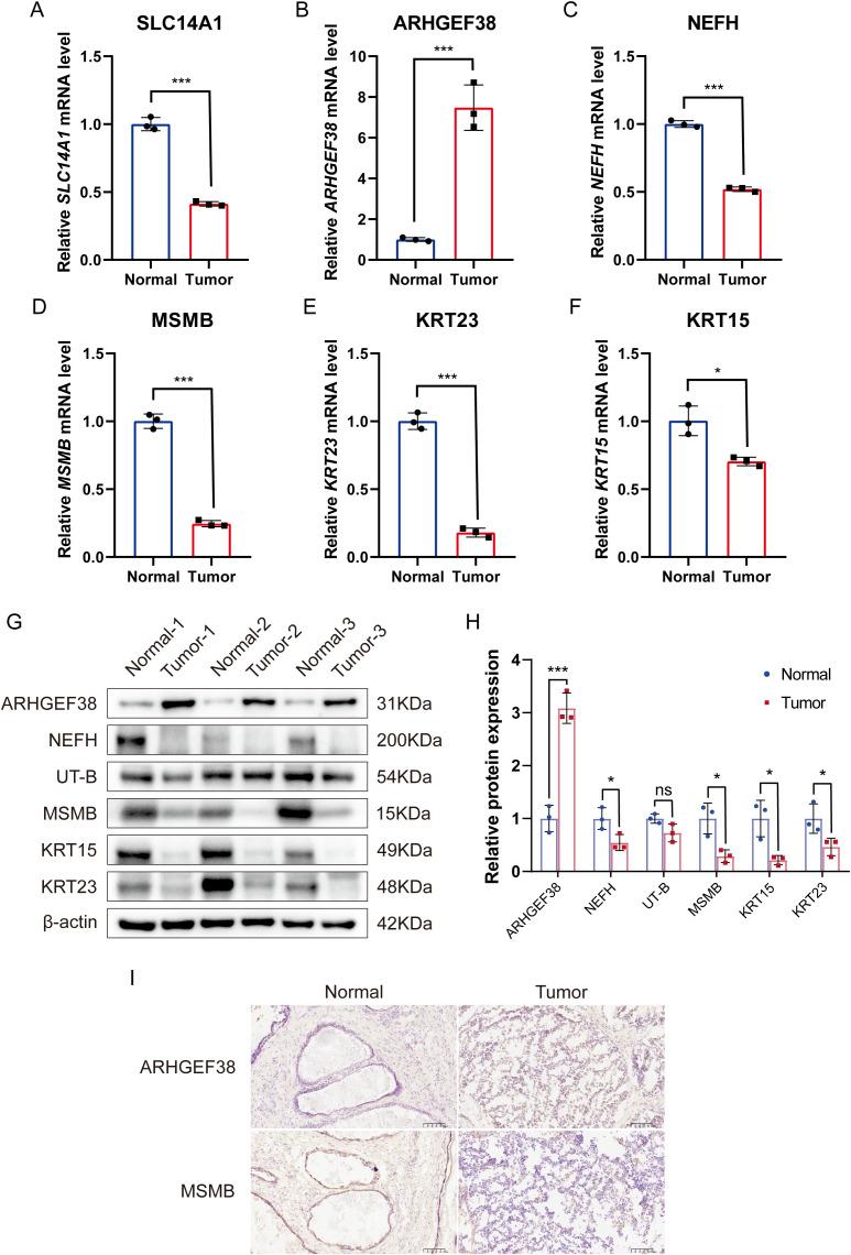 https://cdn.ncbi.nlm.nih.gov/pmc/blobs/0da5/12009700/9d9c736285ad/fonc-15-1534612-g009.jpg
