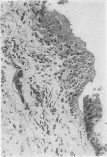 https://cdn.ncbi.nlm.nih.gov/pmc/blobs/0dad/480544/780534b022a7/jclinpath00074-0030-a.jpg