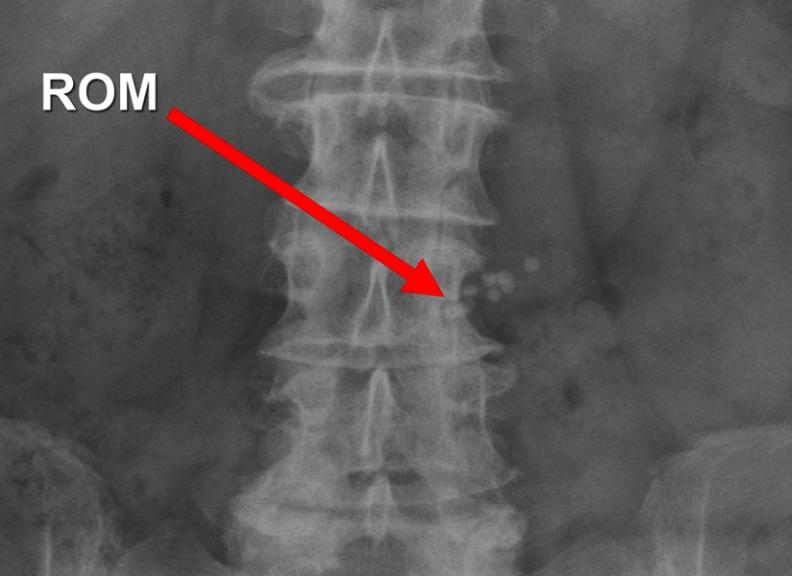 https://cdn.ncbi.nlm.nih.gov/pmc/blobs/0db6/6511612/cbac9b3b37ce/CEG-12-193-g0005.jpg
