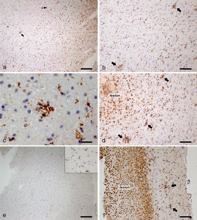 https://cdn.ncbi.nlm.nih.gov/pmc/blobs/0db7/3611040/472431eaaa3e/401_2013_1082_Fig6_HTML.jpg