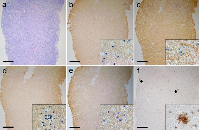 https://cdn.ncbi.nlm.nih.gov/pmc/blobs/0db7/3611040/a122d9cabb15/401_2013_1082_Fig1_HTML.jpg