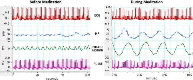https://cdn.ncbi.nlm.nih.gov/pmc/blobs/0dbf/11310241/6fbfc9094ca7/10484_2024_9639_Fig1_HTML.jpg
