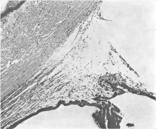https://cdn.ncbi.nlm.nih.gov/pmc/blobs/0dc2/1310470/aa4ddfb36289/taos00029-0603-a.jpg