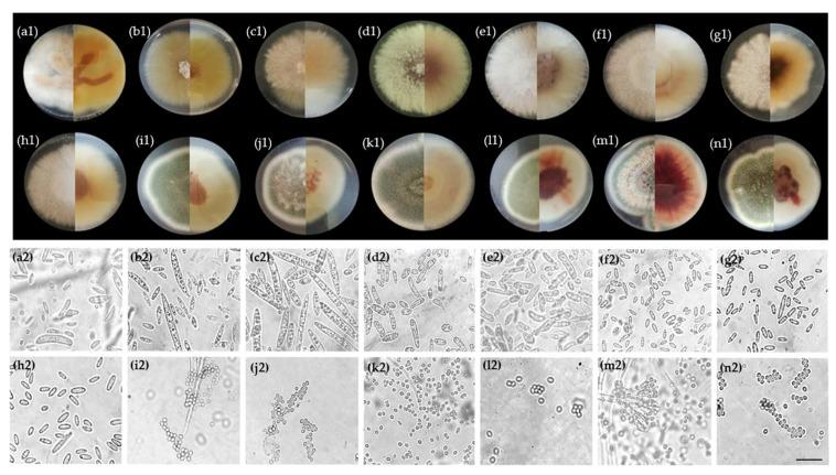 https://cdn.ncbi.nlm.nih.gov/pmc/blobs/0dc2/7997448/e5c400e0e14b/jof-07-00175-g010.jpg