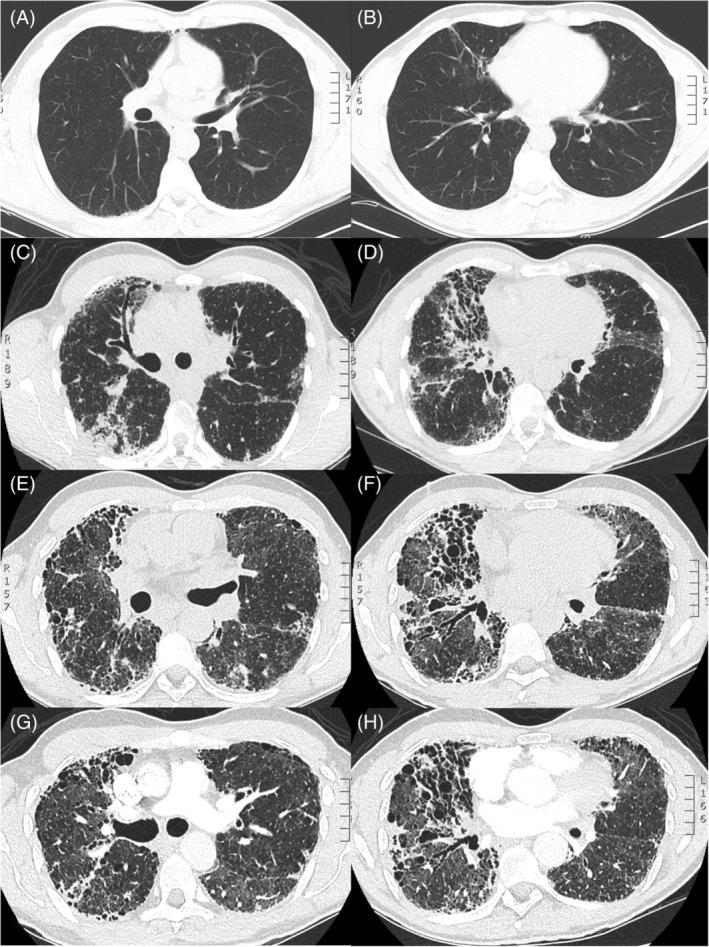 https://cdn.ncbi.nlm.nih.gov/pmc/blobs/0dc4/8569409/4fa9597fcc97/RCR2-9-e0872-g001.jpg