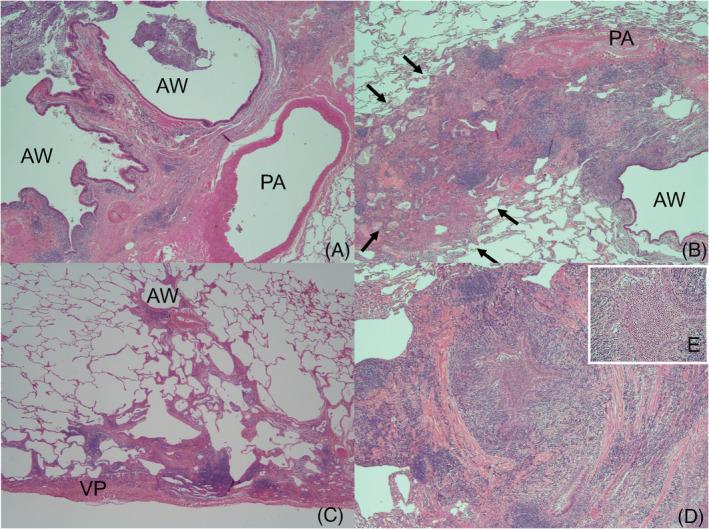 https://cdn.ncbi.nlm.nih.gov/pmc/blobs/0dc4/8569409/5dcc56504c5d/RCR2-9-e0872-g004.jpg