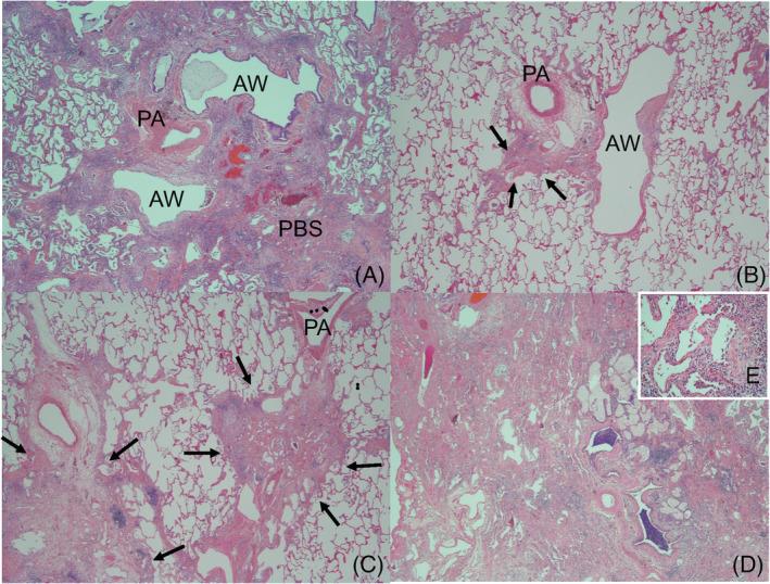 https://cdn.ncbi.nlm.nih.gov/pmc/blobs/0dc4/8569409/ed7ef9447f43/RCR2-9-e0872-g003.jpg