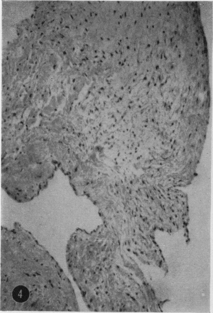 https://cdn.ncbi.nlm.nih.gov/pmc/blobs/0dc8/2093846/028255ee1e0f/brjexppathol00324-0096-a.jpg