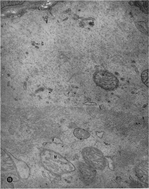 https://cdn.ncbi.nlm.nih.gov/pmc/blobs/0dc8/2093846/b3dd19c02411/brjexppathol00324-0100-a.jpg