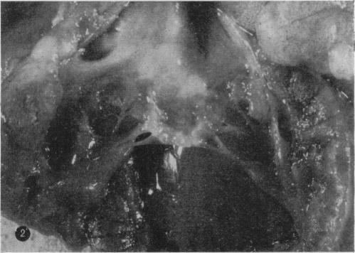 https://cdn.ncbi.nlm.nih.gov/pmc/blobs/0dc8/2093846/d8515fbdc342/brjexppathol00324-0095-b.jpg
