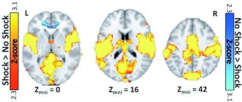 https://cdn.ncbi.nlm.nih.gov/pmc/blobs/0dcf/10597625/922e62fd322d/nsad054f5.jpg