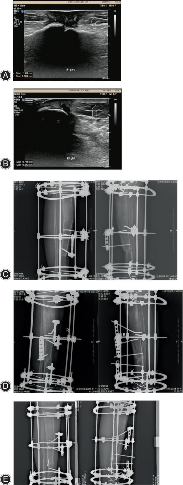https://cdn.ncbi.nlm.nih.gov/pmc/blobs/0dcf/11572575/9d807f66aa5a/OS-16-2264-g001.jpg