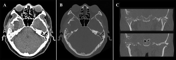 https://cdn.ncbi.nlm.nih.gov/pmc/blobs/0dd6/7953063/c5c4bb650175/fonc-11-643635-g001.jpg