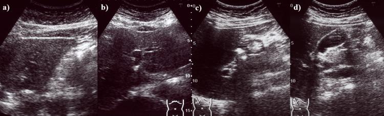 https://cdn.ncbi.nlm.nih.gov/pmc/blobs/0dd7/10943568/836a97e84c7b/cureus-0016-00000054227-i02.jpg