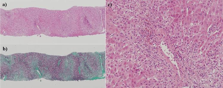 https://cdn.ncbi.nlm.nih.gov/pmc/blobs/0dd7/10943568/bc65c3dcbbfd/cureus-0016-00000054227-i04.jpg