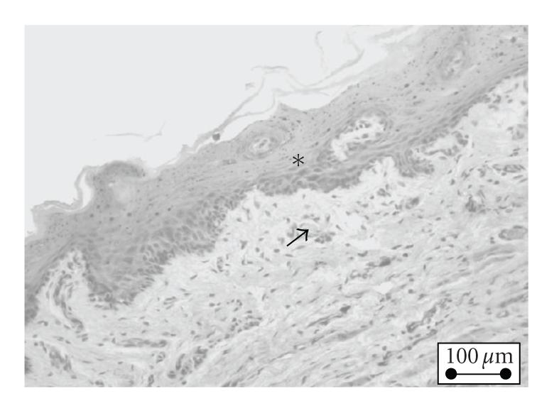 https://cdn.ncbi.nlm.nih.gov/pmc/blobs/0ddf/2836915/68e12aadef9b/IJD2009-725628.003.jpg