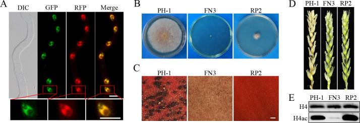 https://cdn.ncbi.nlm.nih.gov/pmc/blobs/0de3/7660929/61bbf90f5d1d/pgen.1009185.g008.jpg