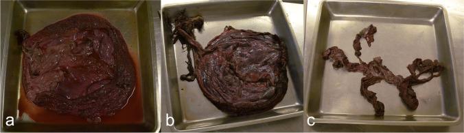 https://cdn.ncbi.nlm.nih.gov/pmc/blobs/0deb/11467087/9b82252b84d6/11356_2024_34980_Fig2_HTML.jpg
