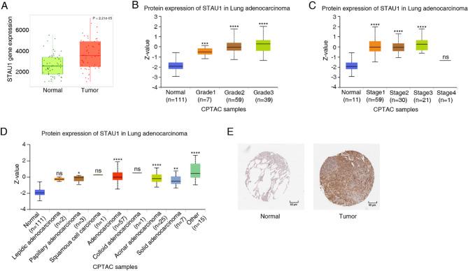 https://cdn.ncbi.nlm.nih.gov/pmc/blobs/0df4/12084350/7f3bd0aaa005/41598_2025_1883_Fig1_HTML.jpg