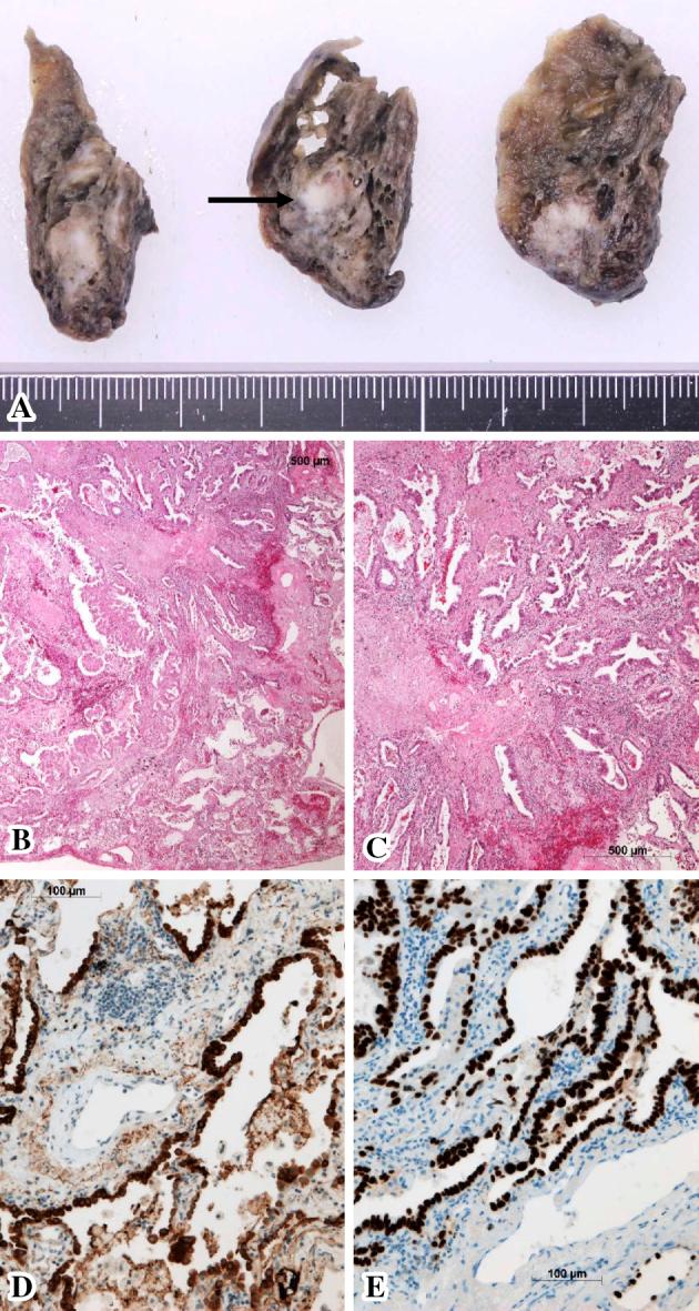 https://cdn.ncbi.nlm.nih.gov/pmc/blobs/0df6/5849549/9dd6af742c4f/1349-7235-57-0527-g002.jpg