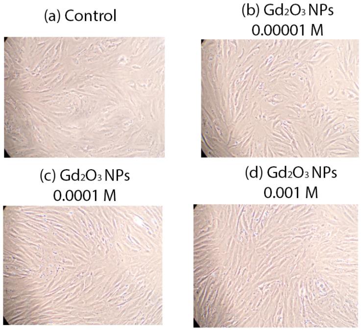 https://cdn.ncbi.nlm.nih.gov/pmc/blobs/0e03/11676666/210018132b1d/pharmaceutics-16-01627-g008.jpg