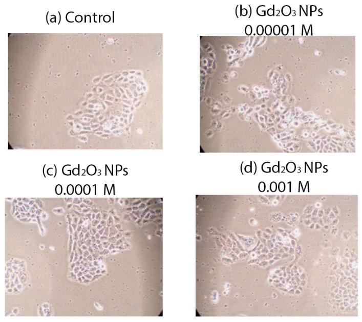 https://cdn.ncbi.nlm.nih.gov/pmc/blobs/0e03/11676666/7e0d02645eca/pharmaceutics-16-01627-g011.jpg