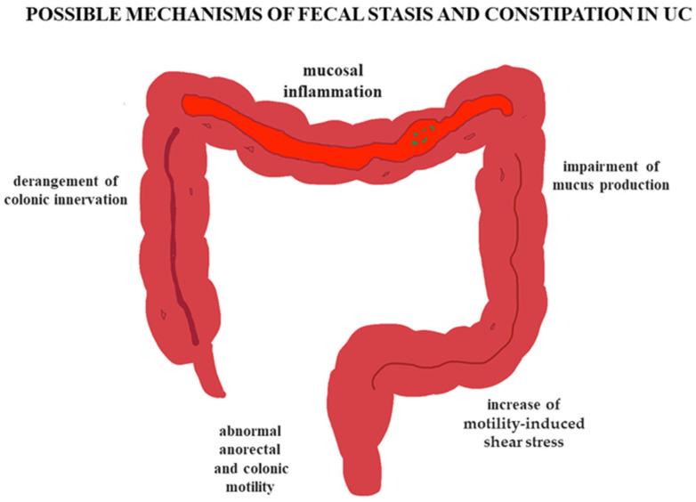 https://cdn.ncbi.nlm.nih.gov/pmc/blobs/0e05/12347732/baf0e11d034b/jcm-14-05428-g002.jpg