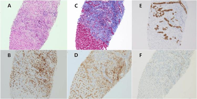 https://cdn.ncbi.nlm.nih.gov/pmc/blobs/0e05/12395391/0f7fb198ce4d/cureus-0017-00000089042-i03.jpg