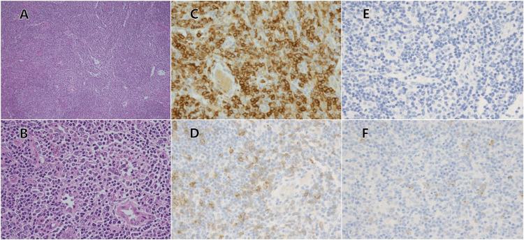 https://cdn.ncbi.nlm.nih.gov/pmc/blobs/0e05/12395391/2d5bb9203916/cureus-0017-00000089042-i02.jpg