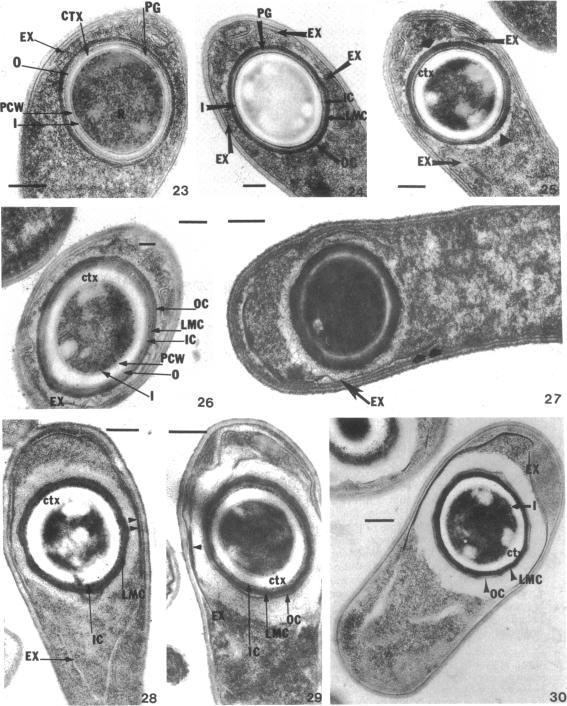 https://cdn.ncbi.nlm.nih.gov/pmc/blobs/0e06/246190/9b7f05f10d62/jbacter00331-0550-a.jpg