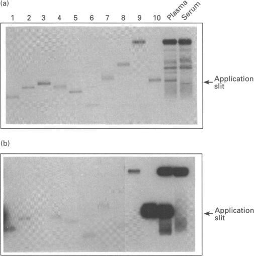 https://cdn.ncbi.nlm.nih.gov/pmc/blobs/0e0a/1138247/4fdee3bbbad4/biochemj00085-0266-a.jpg