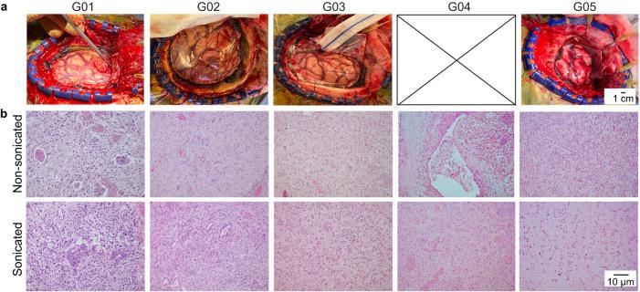 https://cdn.ncbi.nlm.nih.gov/pmc/blobs/0e10/10505140/9ca9ca83febd/41698_2023_448_Fig4_HTML.jpg