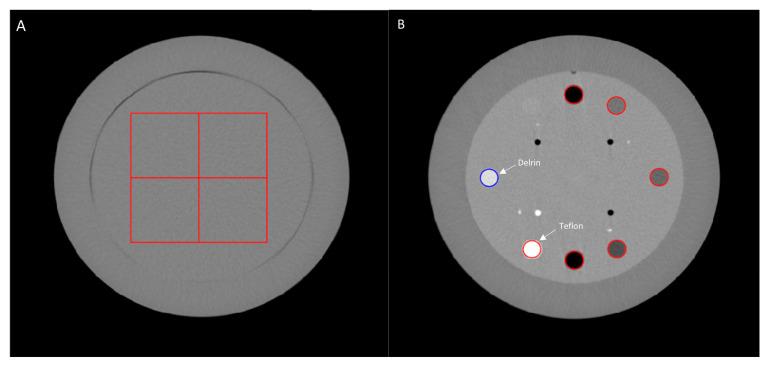 https://cdn.ncbi.nlm.nih.gov/pmc/blobs/0e17/11548279/0f86dc1ecf68/sensors-24-06883-g002.jpg