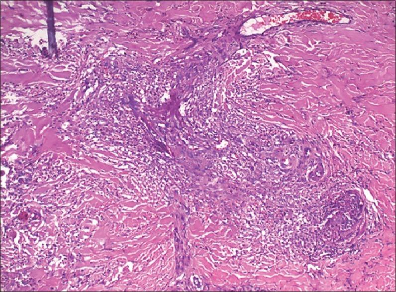 https://cdn.ncbi.nlm.nih.gov/pmc/blobs/0e19/4857691/a1270f0c232f/IJSTD-37-81-g002.jpg