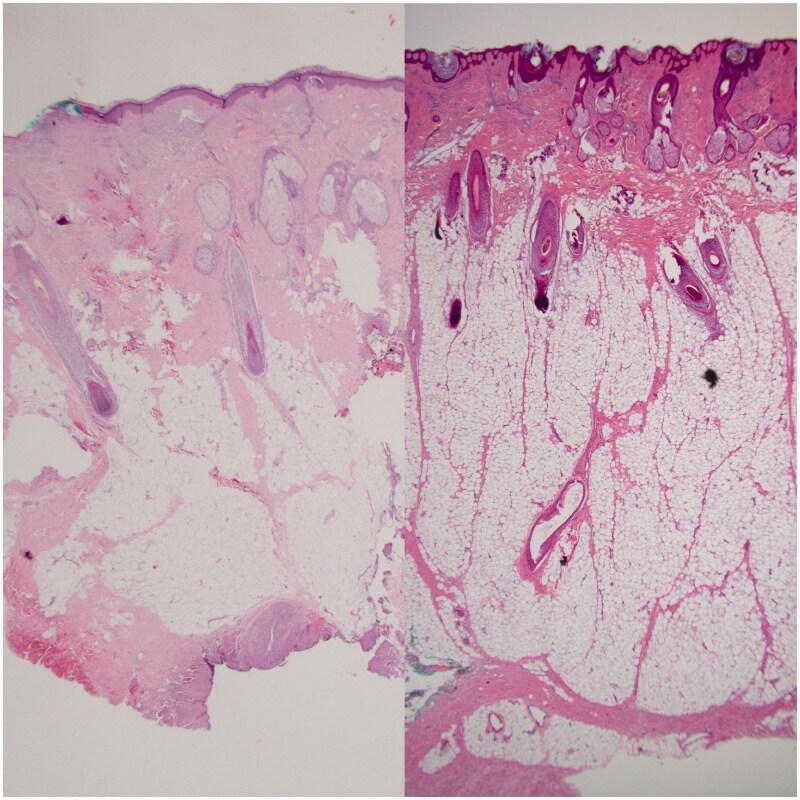 https://cdn.ncbi.nlm.nih.gov/pmc/blobs/0e1b/7594736/0df3cbe62337/ICRP_A_1833334_F0003_C.jpg