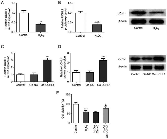 https://cdn.ncbi.nlm.nih.gov/pmc/blobs/0e1b/9905655/9e1e70614a2a/etm-25-02-11793-g00.jpg