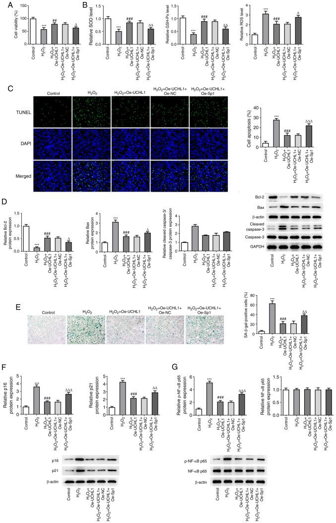 https://cdn.ncbi.nlm.nih.gov/pmc/blobs/0e1b/9905655/ed7a5de303ef/etm-25-02-11793-g04.jpg