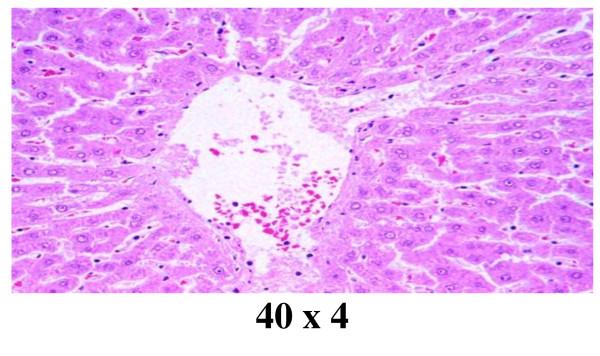 https://cdn.ncbi.nlm.nih.gov/pmc/blobs/0e1d/3281779/3329a7f4d8c8/1477-3155-10-5-9.jpg