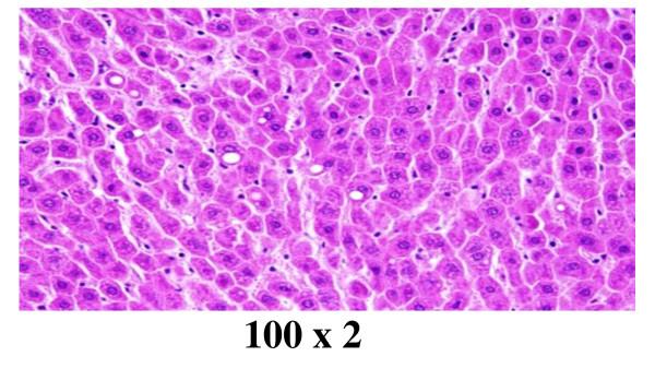 https://cdn.ncbi.nlm.nih.gov/pmc/blobs/0e1d/3281779/5eea714d0dd8/1477-3155-10-5-12.jpg